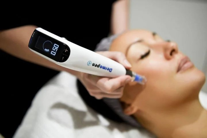 medical microneedling